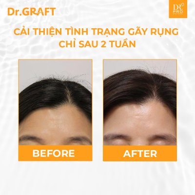 Dr.GRAFT Aranea Treatment | Mặt nạ tóc Dr.GRAFT Aranea - 200ml