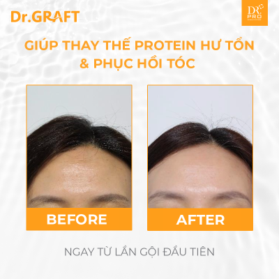 Dr.GRAFT SCALP SHAMPOO | Dầu gội Dr.GRAFT Scalp-30 gói x 8ml