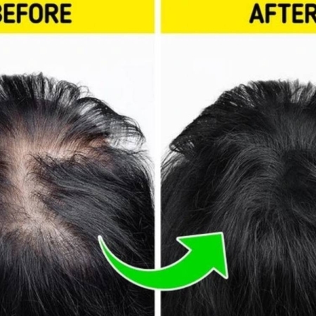 Có nên dùng dầu gội kích thích mọc tóc hàng ngày không?