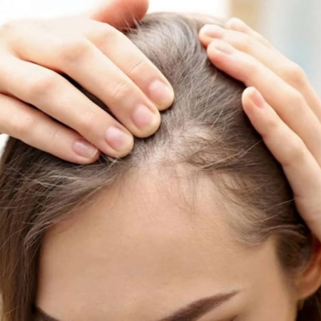 Nguyên nhân phổ biến khiến tóc mỏng yếu và cách khắc phục