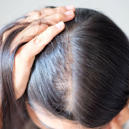 Tóc mỏng thưa nên dùng sản phẩm nào để cải thiện?