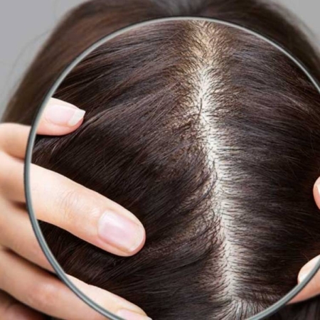 Mẹo làm sạch da đầu mà không làm khô tóc