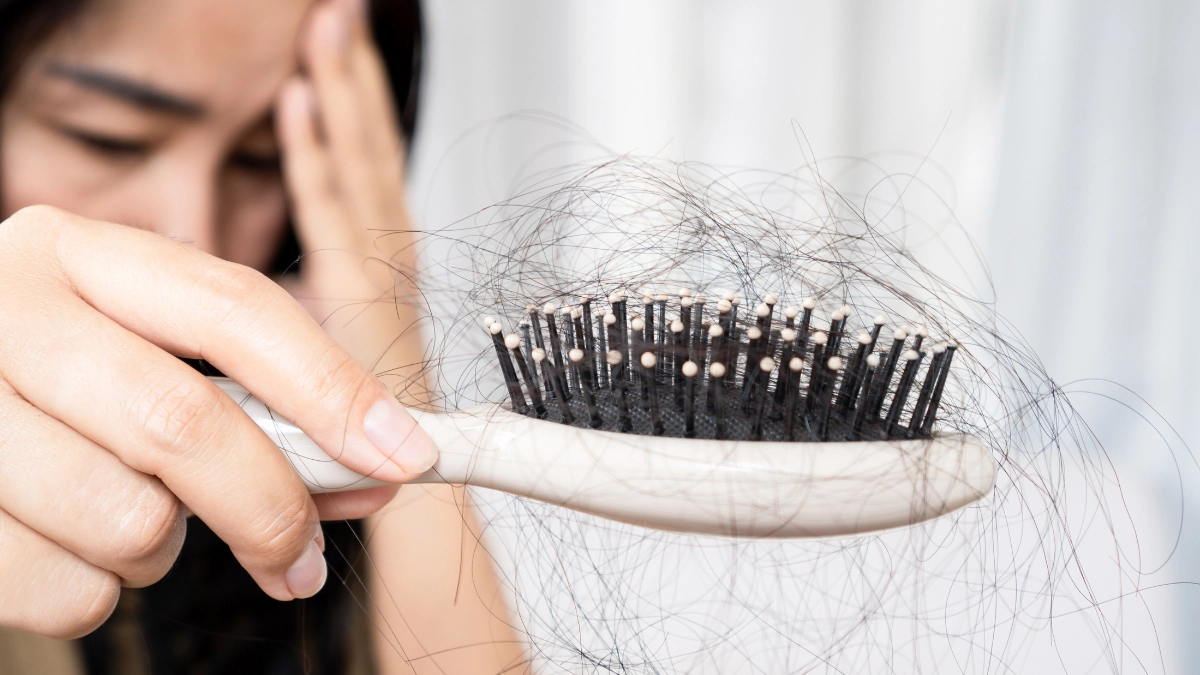  NGUYÊN NHÂN RỤNG TÓC, ĐIỀU TRỊ VÀ HƯỚNG DẪN PHỤC HỒI TOÀN DIỆN