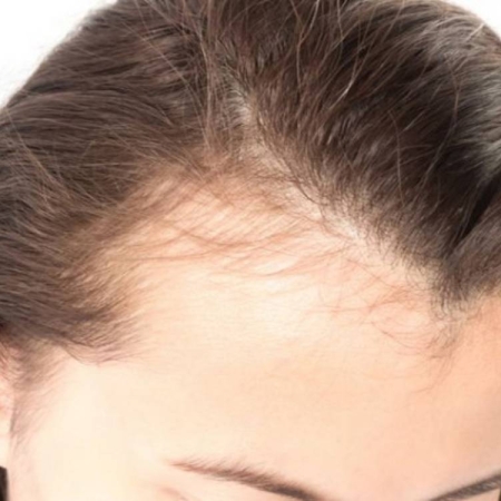 Combo chăm sóc tóc dành cho dân văn phòng bị stress