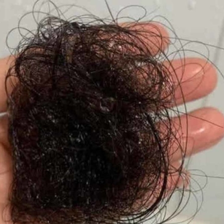 Review thực tế sản phẩm Dr.Graft sau 1 tháng sử dụng