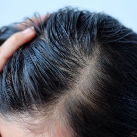 Tóc dầu và cách lựa chọn sản phẩm phù hợp