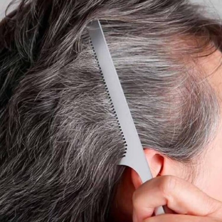 Phục hồi tóc yếu mỏng cho người trung niên