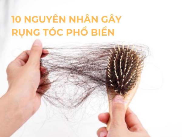 10 Nguyên Nhân Rụng Tóc Phổ Biến