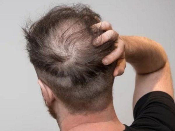 Câu chuyện khách hàng: Lột xác ngoạn mục sau khi dùng Dr.Graft