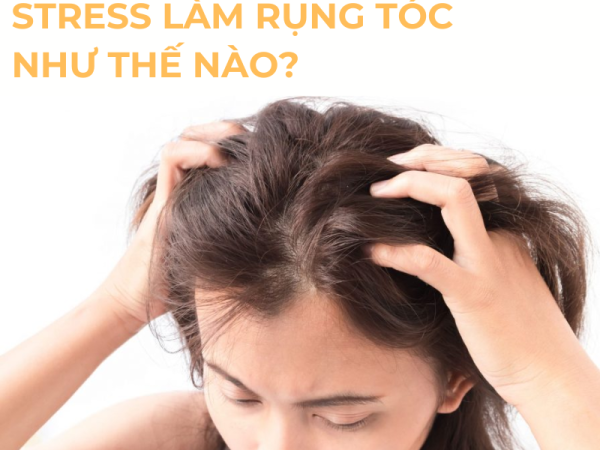 Rụng Tóc Nhiều Do Căng Thẳng: Nguyên Nhân Và Cách Khắc Phục