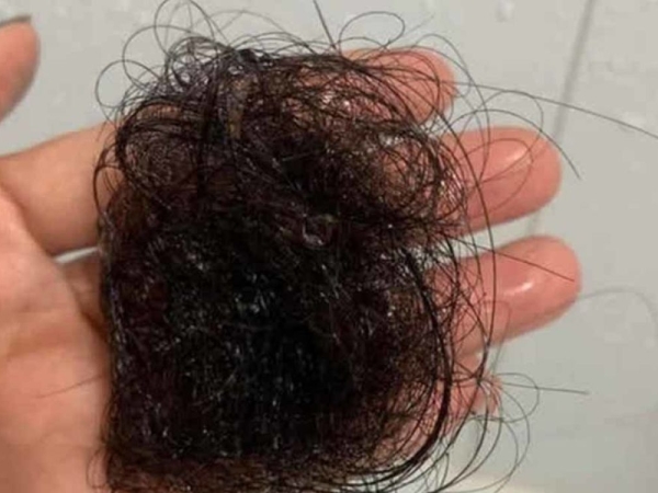 Review thực tế sản phẩm Dr.Graft sau 1 tháng sử dụng