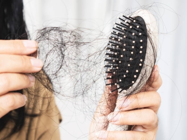 Top 10 mẹo giúp phục hồi tóc gãy rụng hiệu quả tại nhà