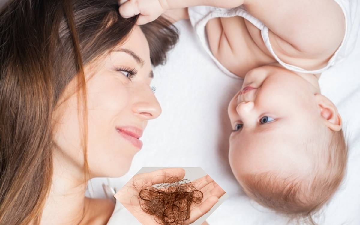 Phụ nữ sau khi sinh con thường gặp tình trạng rụng tóc