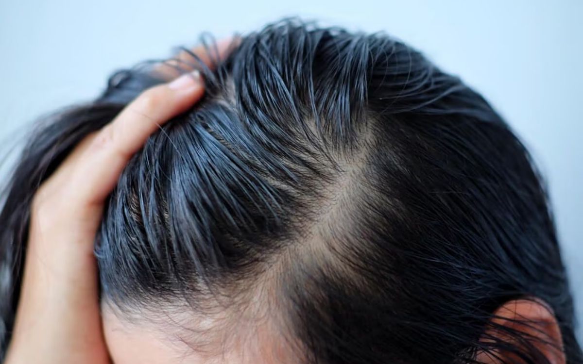 Tóc bết dầu có thể do nhiều yếu tố